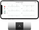 KardiaMobile 6-Lead Personal EKG Monitor – Six Views of The Heart – Detects AFib and Irregular Arrhythmias – Instant Results in 30 Seconds – Works with Most Smartphones - FSA/HSA Eligible - Image 2